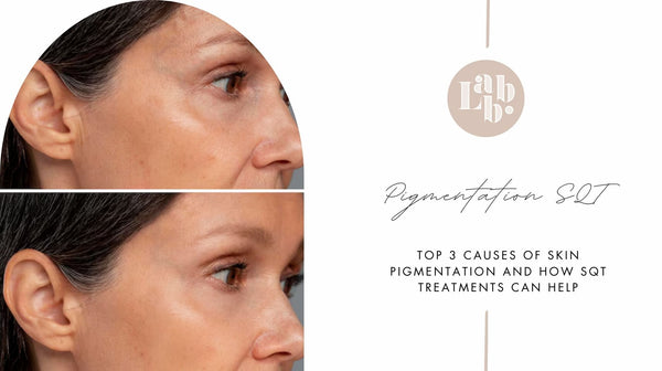 Top 3 Causes of Skin Pigmentation and How SQT Treatments Can Help