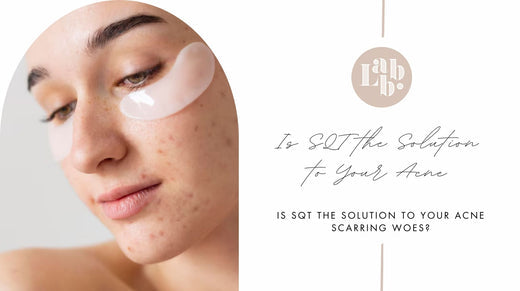 Is SQT the Solution to Your Acne Scarring Woes?