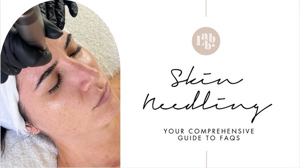 Skin Needling - Your Comprehensive Guide to FAQ's